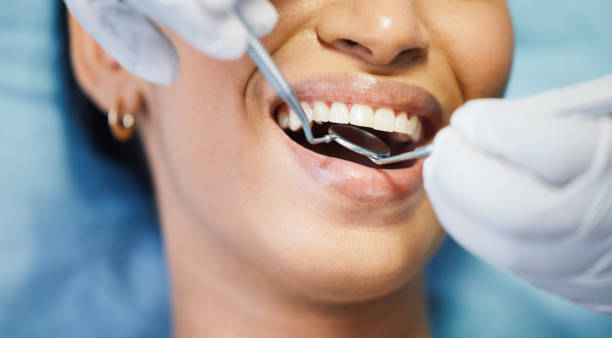 Best Emergency Dental Extractions in Ocoee, FL